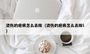 烫伤的疤痕怎么去除（烫伤的疤痕怎么去除l）