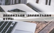 烫伤的疤痕怎么去除（烫伤的疤痕怎么去除丰田卡罗拉）