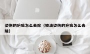 烫伤的疤痕怎么去除（被油烫伤的疤痕怎么去除）