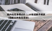 国内检出多例xbb.1.16有结膜炎症状（结膜炎种类及症状）